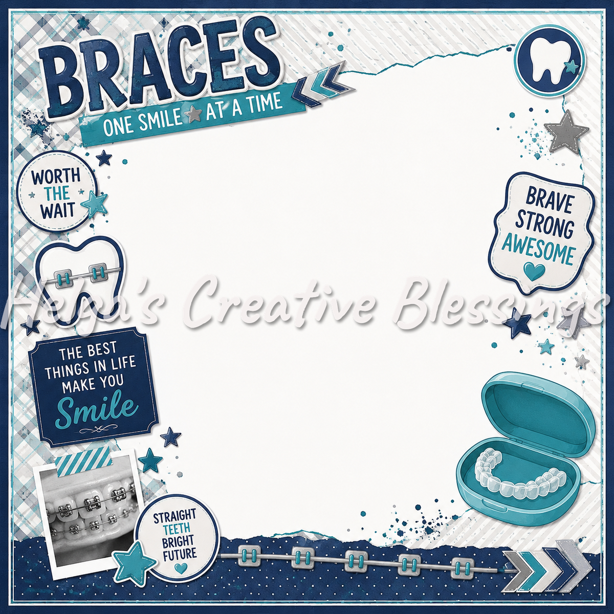 Braces Frame
